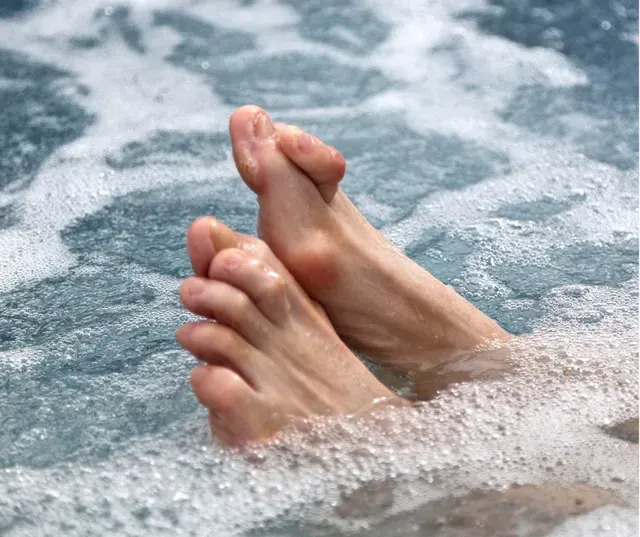 Hammer Toes