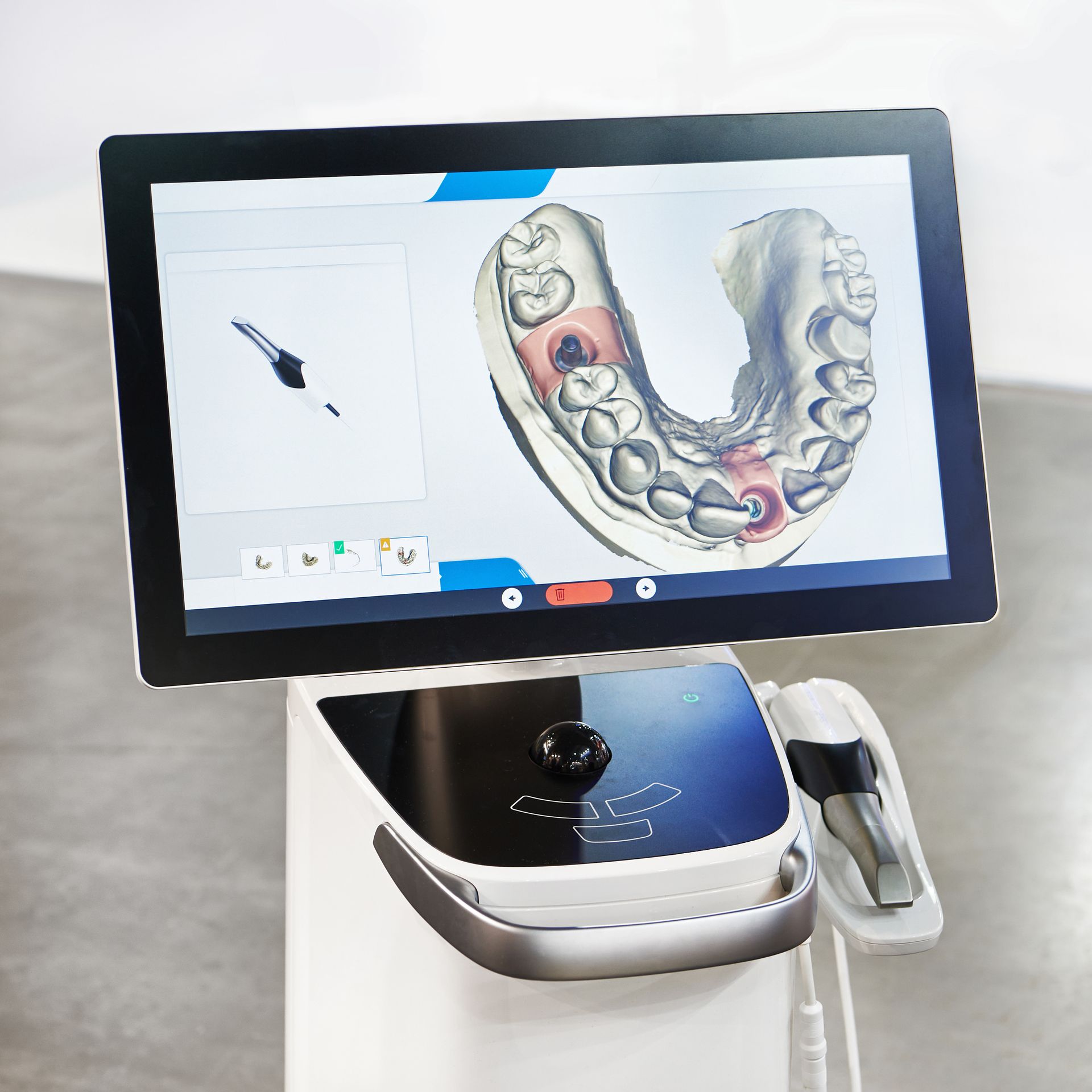 Dental scanner displaying a 3D model of teeth with a handheld scanning wand.