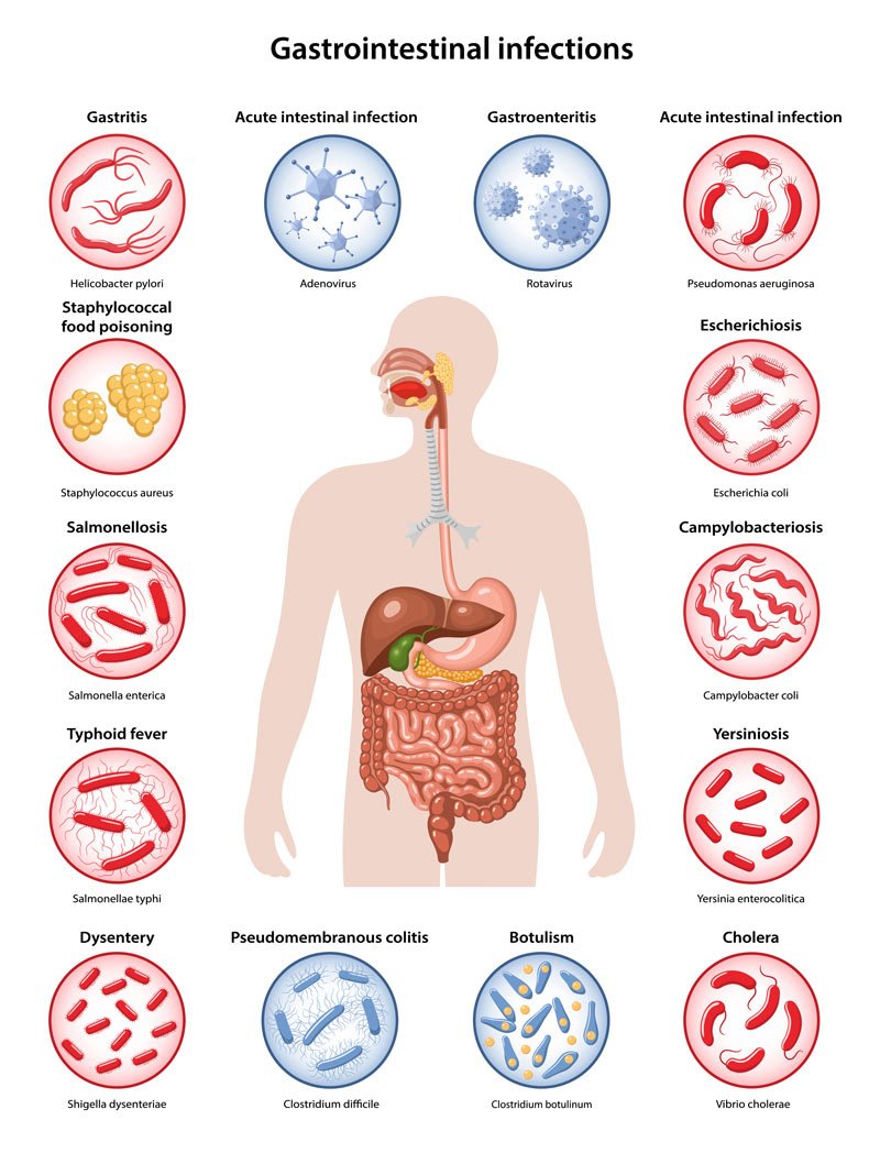 Gastroenteritis Remedies Dr Michael Minond NYC Chiropractor Gastroenteritis Remedies Dr Michael Minond NYC Chiropractor