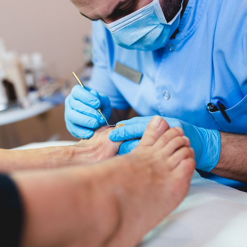 A foot doctor in blue gloves and mask offering ingrown toenail removal with a small instrument