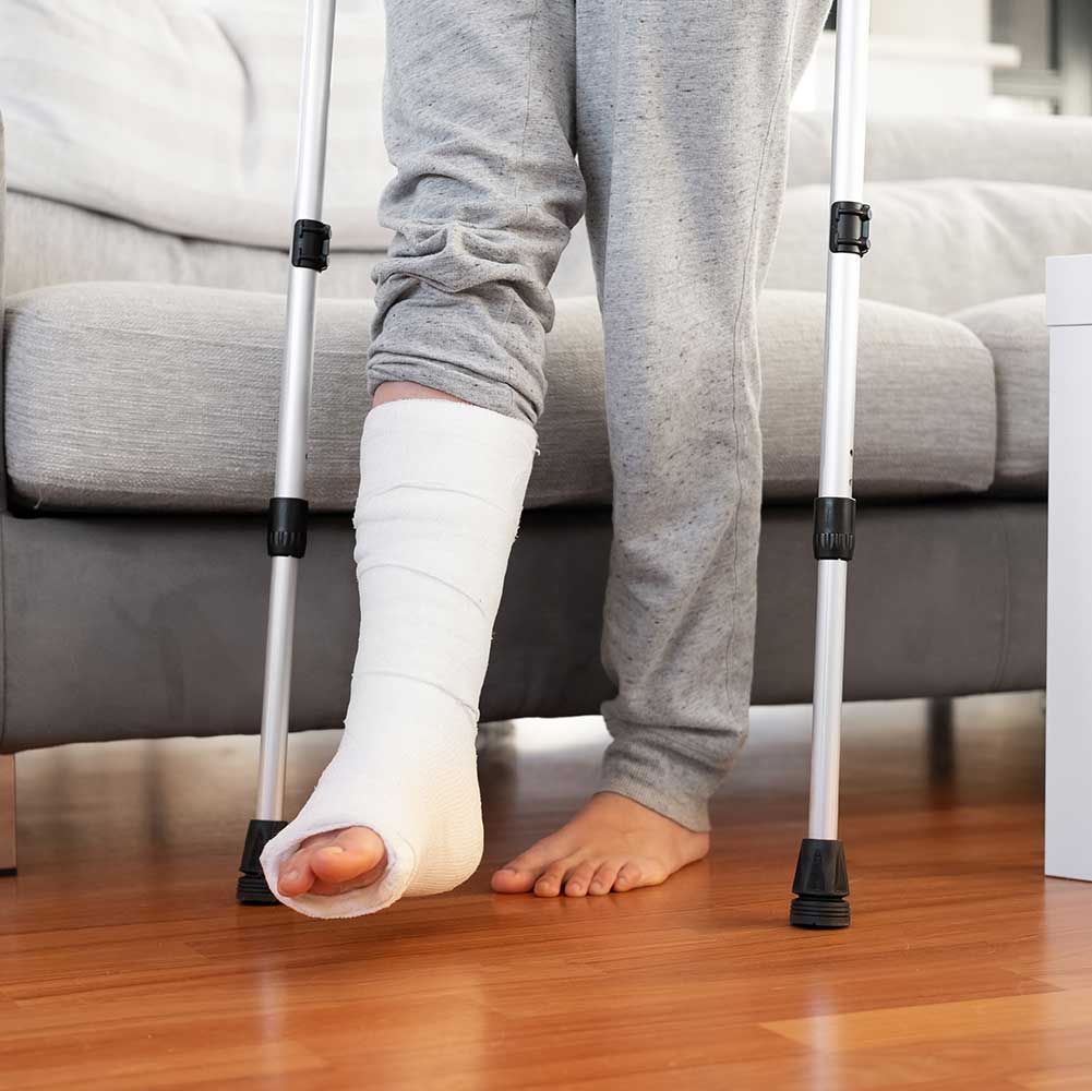 Woman with leg in gypsum plaster on elbow crutches in the Wolcott, CT area