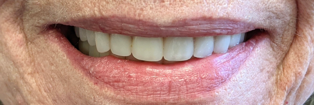 Close-up of a smiling mouth with bright white teeth and pink lipstick.