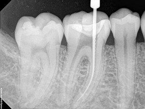 Dental X-ray — Wilmington, DE — New Concept Dental Dental X-ray — Wilmington, DE — New Concept Dental