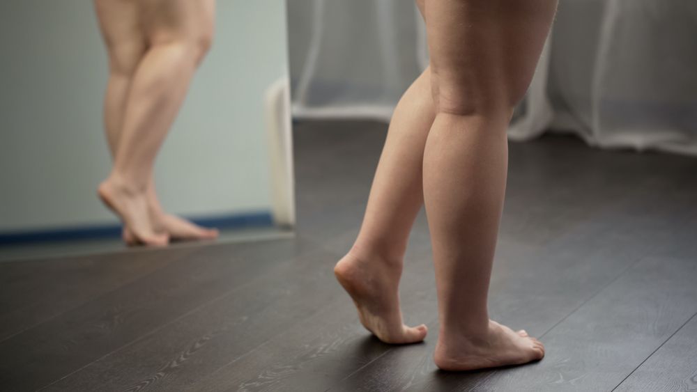 Leg Swelling