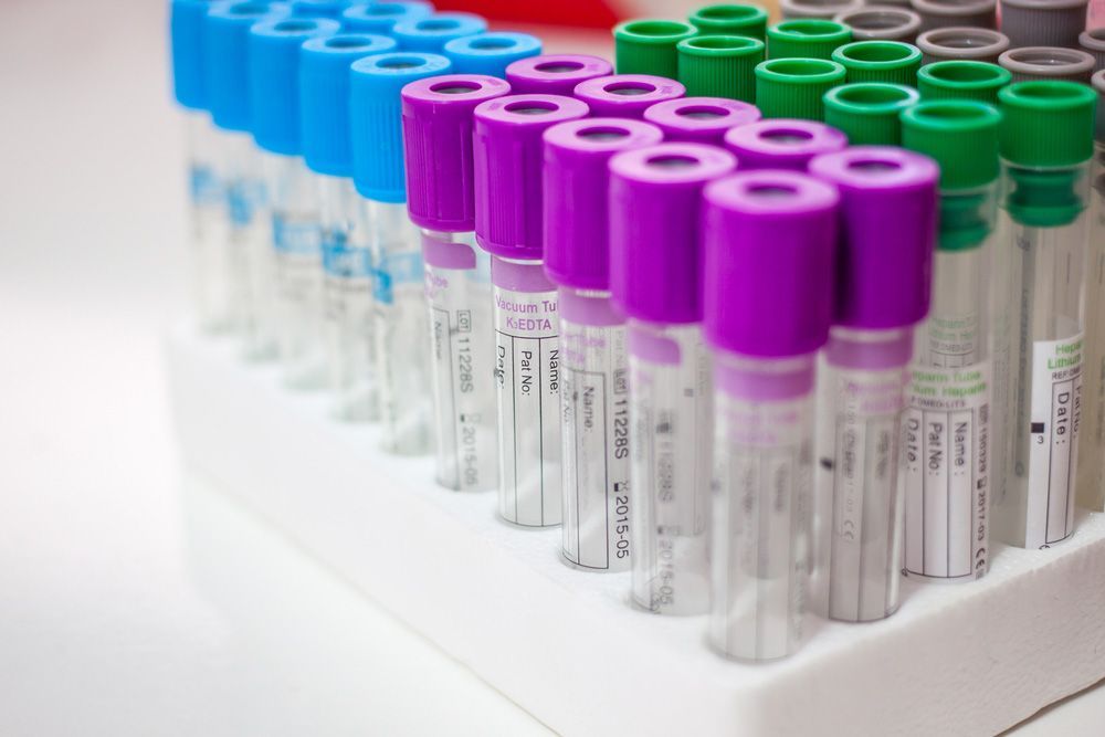 A Row Of Test Tubes With Different Colored Caps Are Lined Up On A Table — Eureka Water & Filtration In Mount St John, QLD
