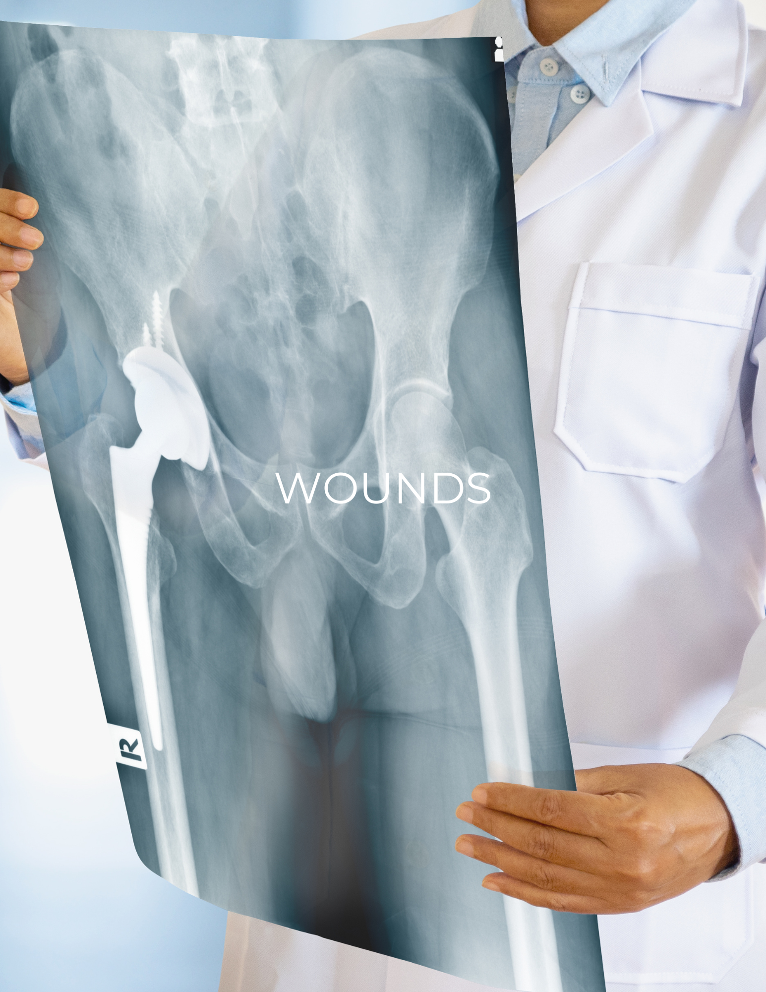 Doctor holding a hip X-ray with the word “WOUNDS” overlaid