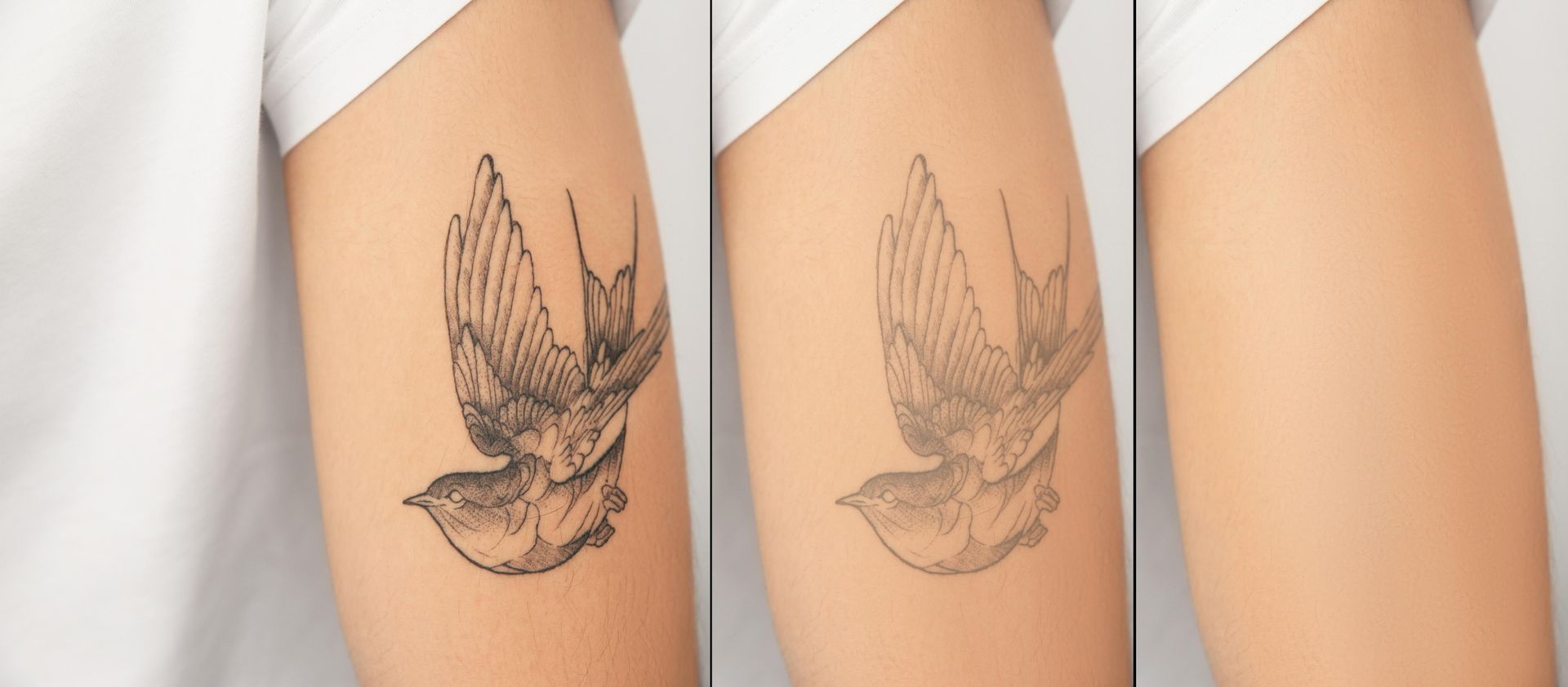 Tattoo Fading: Arm With A Bird Tattoo, Partially Faded, Then Fully Faded Skin — Tattoo Inc Studio in Robina, QLD