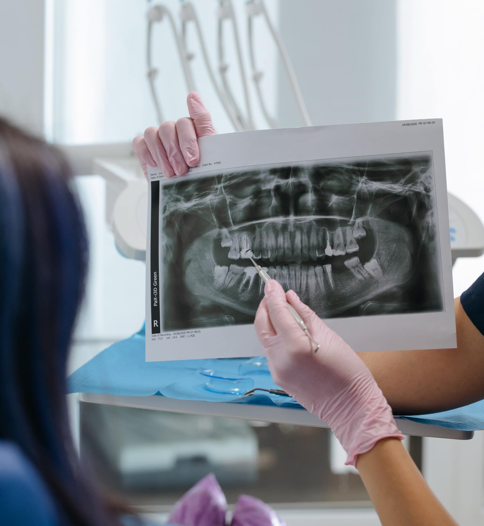 Gum Grafts | X-Rays | Amherst, NY