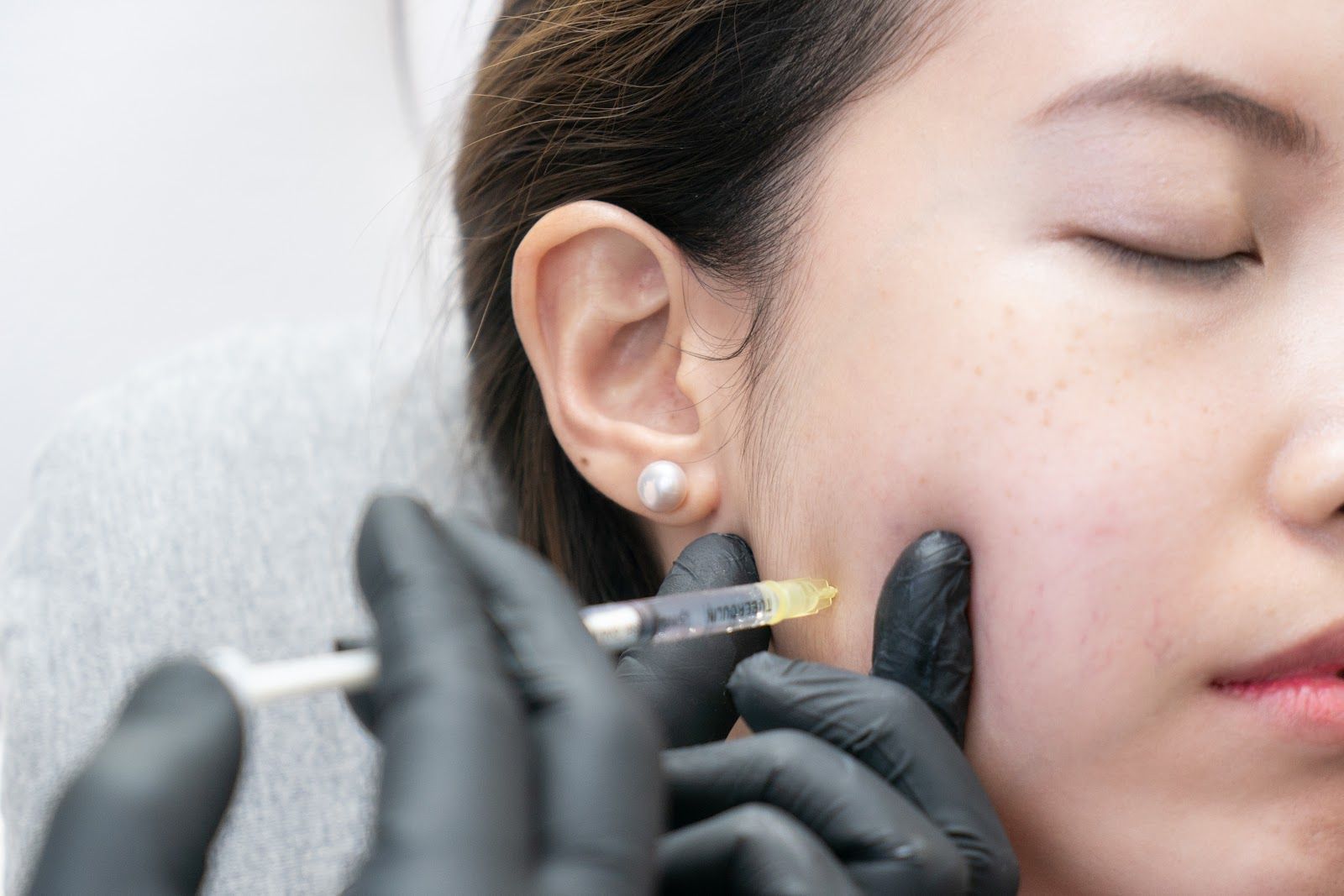Gloved hands injecting filler into a woman’s cheek during a cosmetic procedure