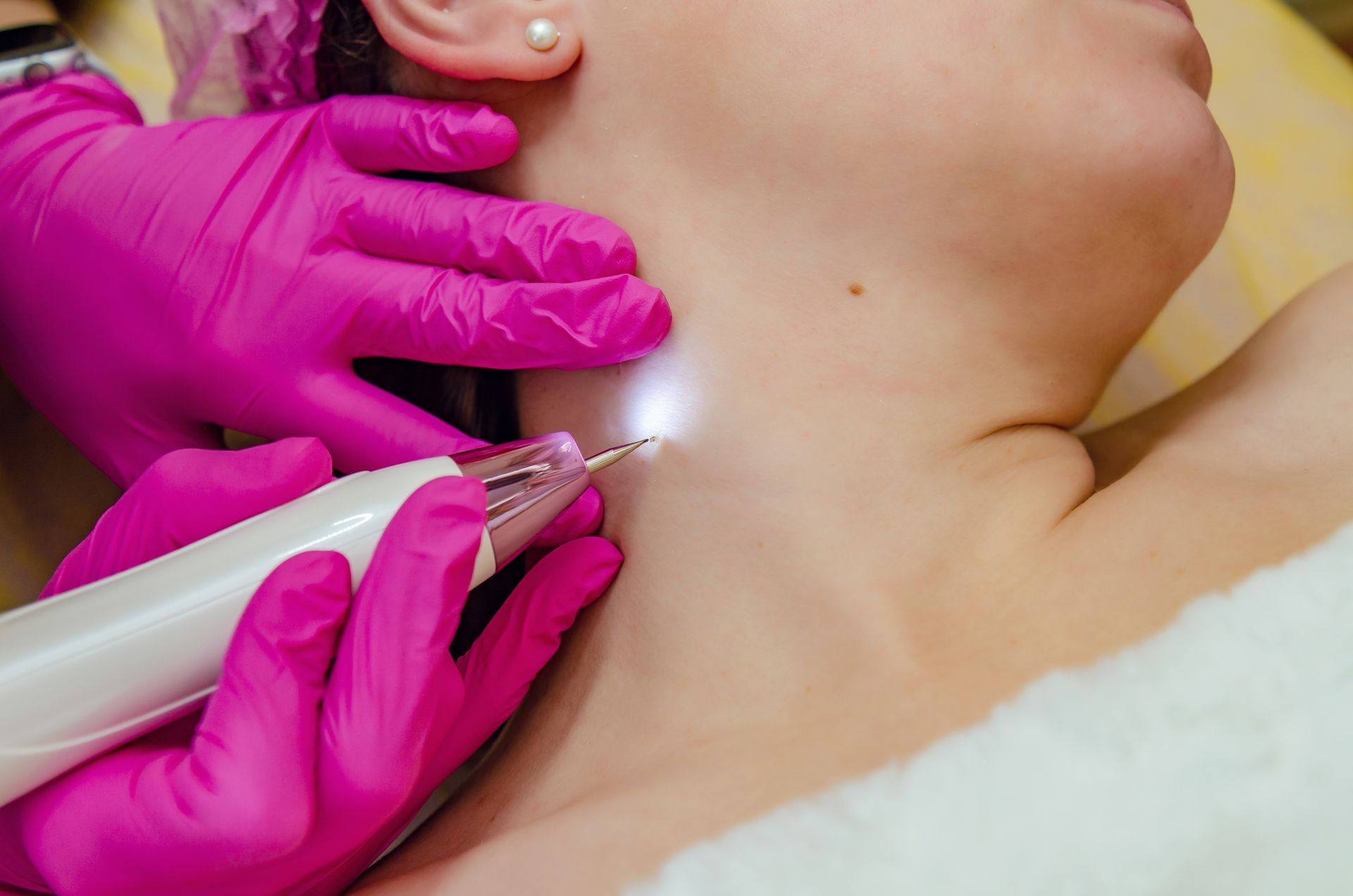 A woman is getting a laser treatment on her neck.