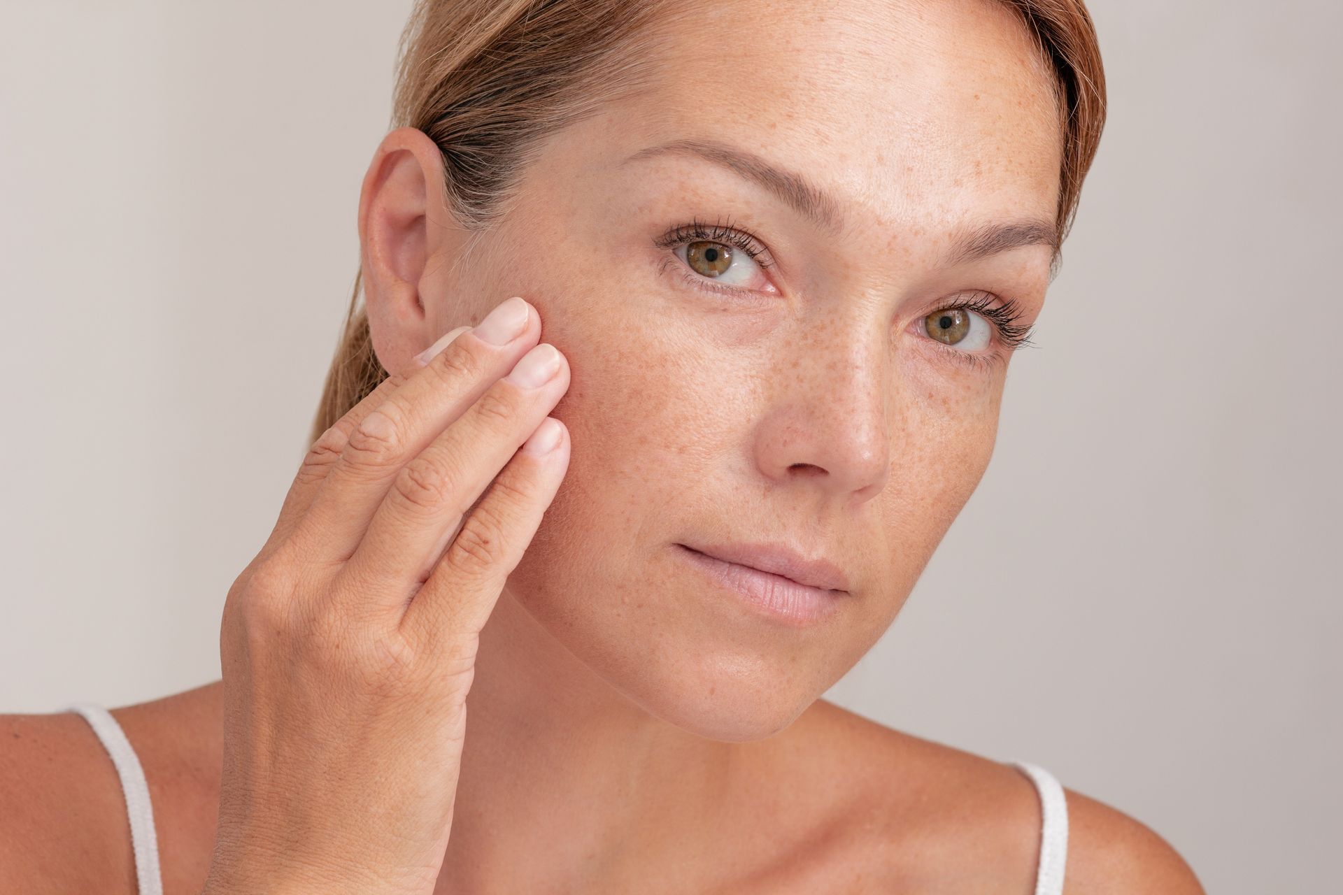woman showing sun spots on her face