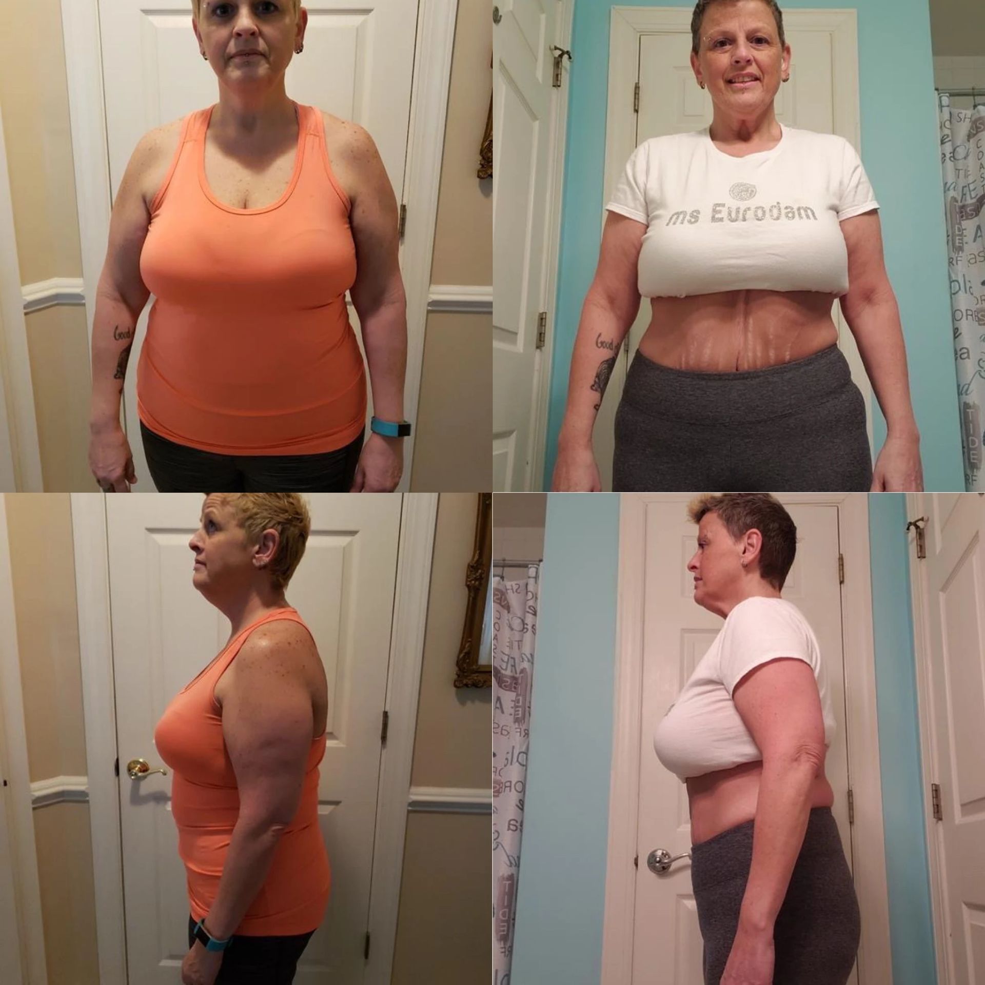 before and after