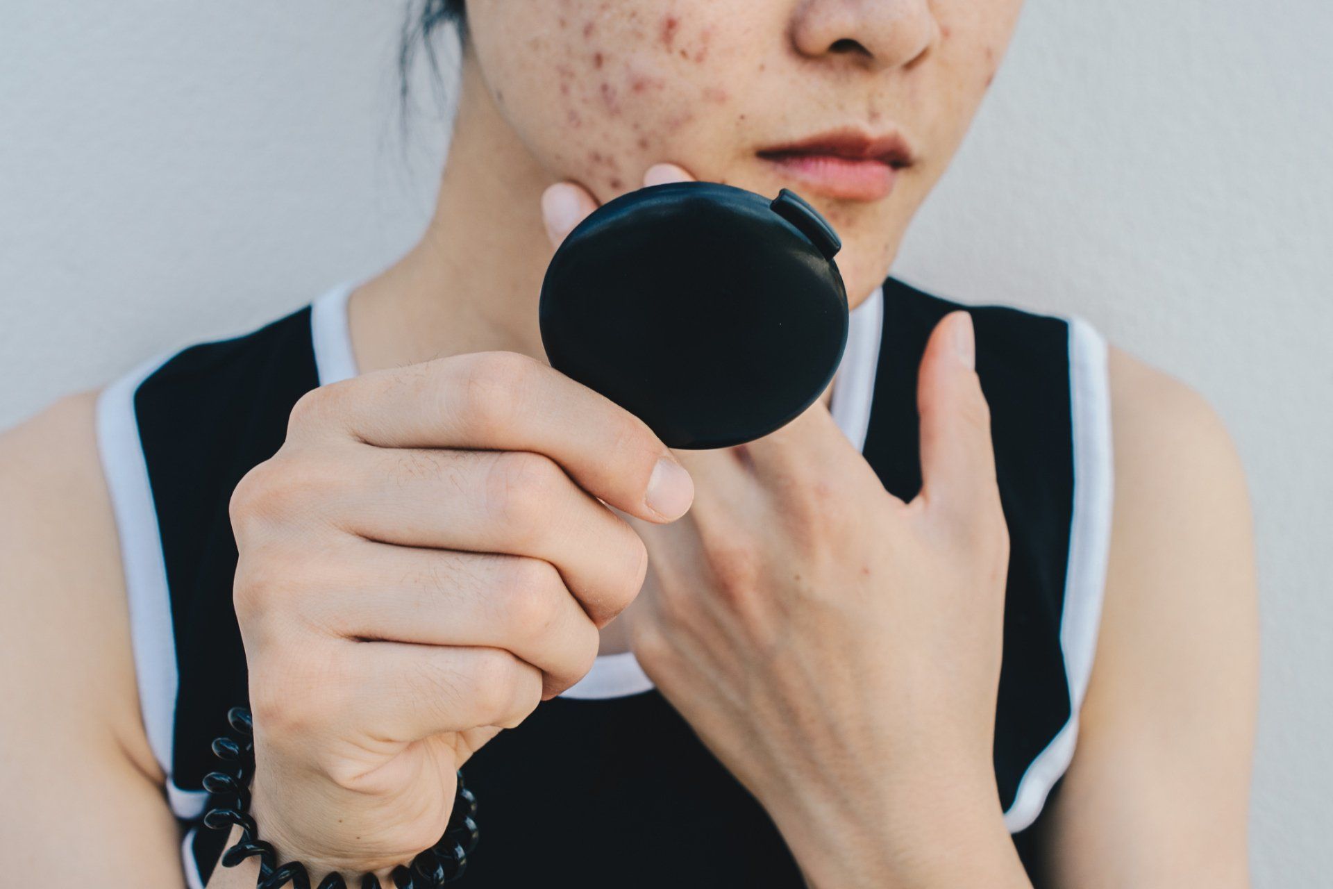 Skin Dermatology — Chico, CA — Mangrove Medical Group