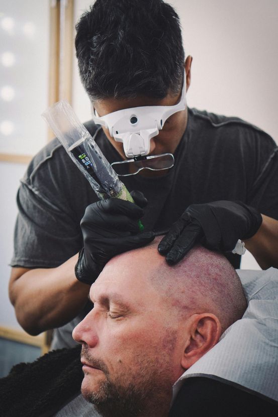 Man receiving scalp micropigmentation, artist with magnifying glasses, black gloves, focused.