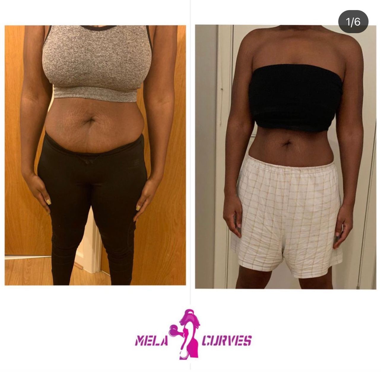 A before and after picture of a woman 's stomach