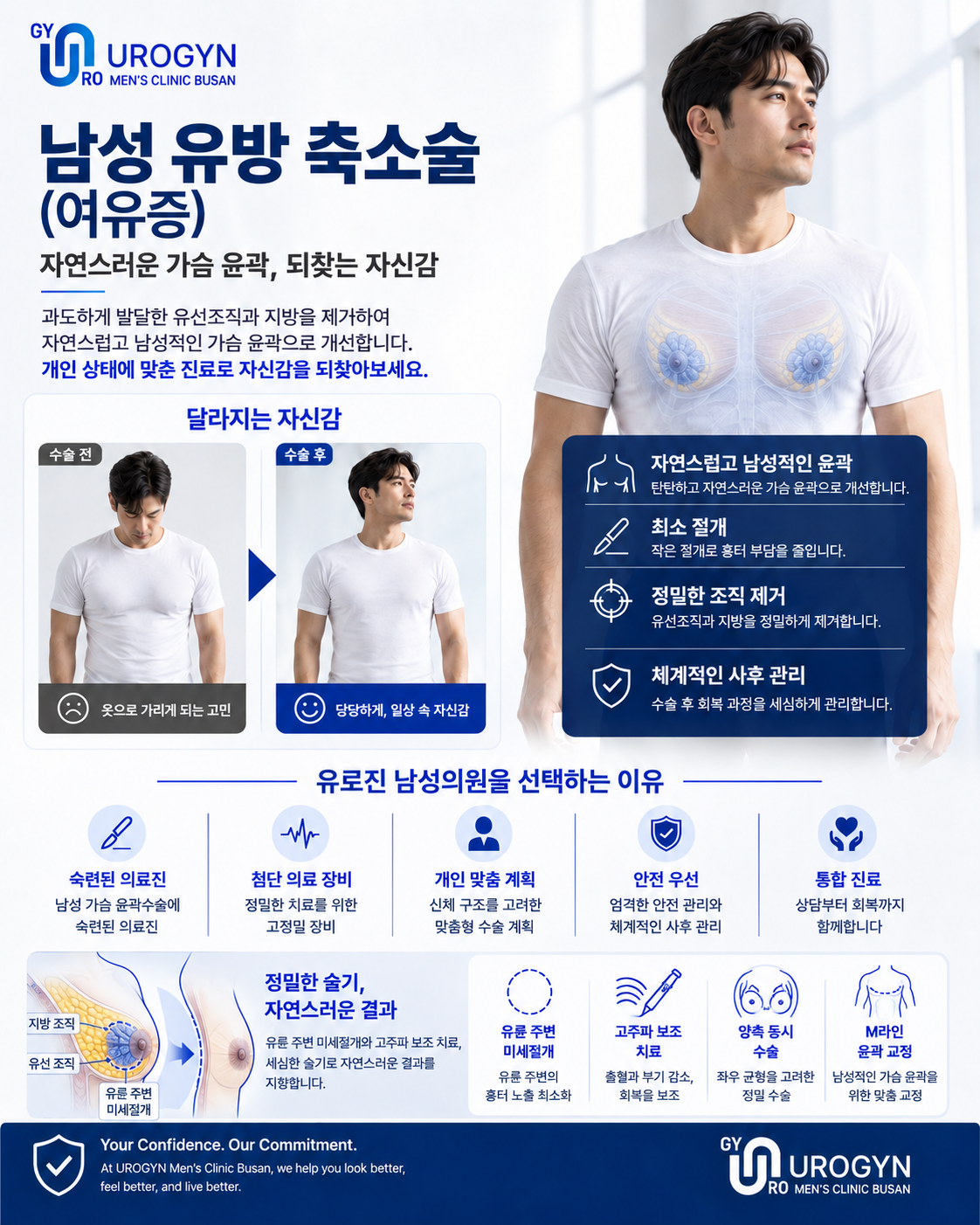 여유증 수술 — 부산 서면 유로진남성의원