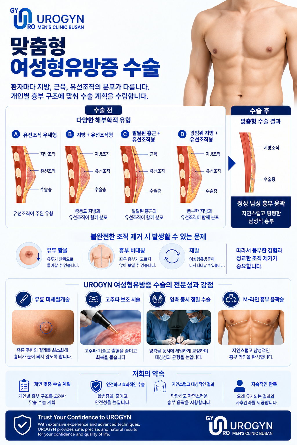베이저 여유증 수술 과정 — 부산 서면 유로진남성의원