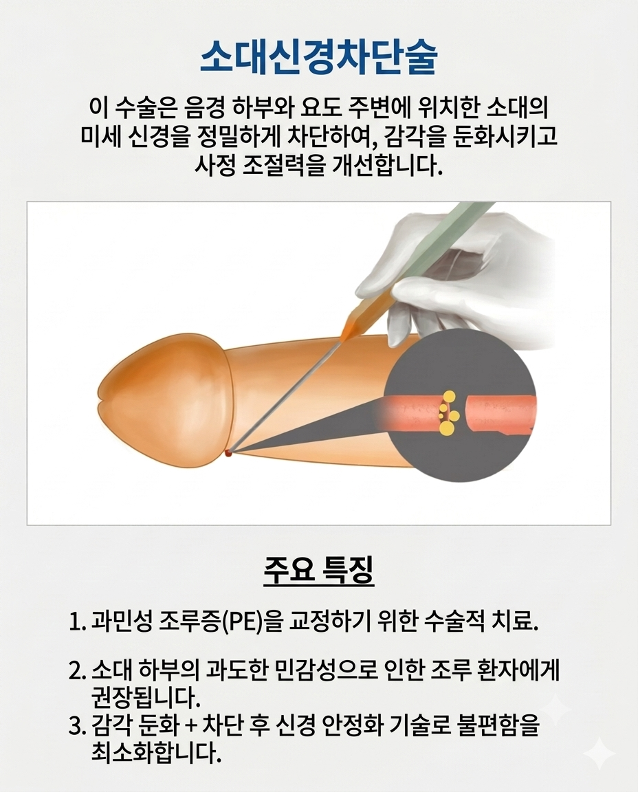 소대 신경차단 시술 모식도 — 부산 서면 유로진남성의원