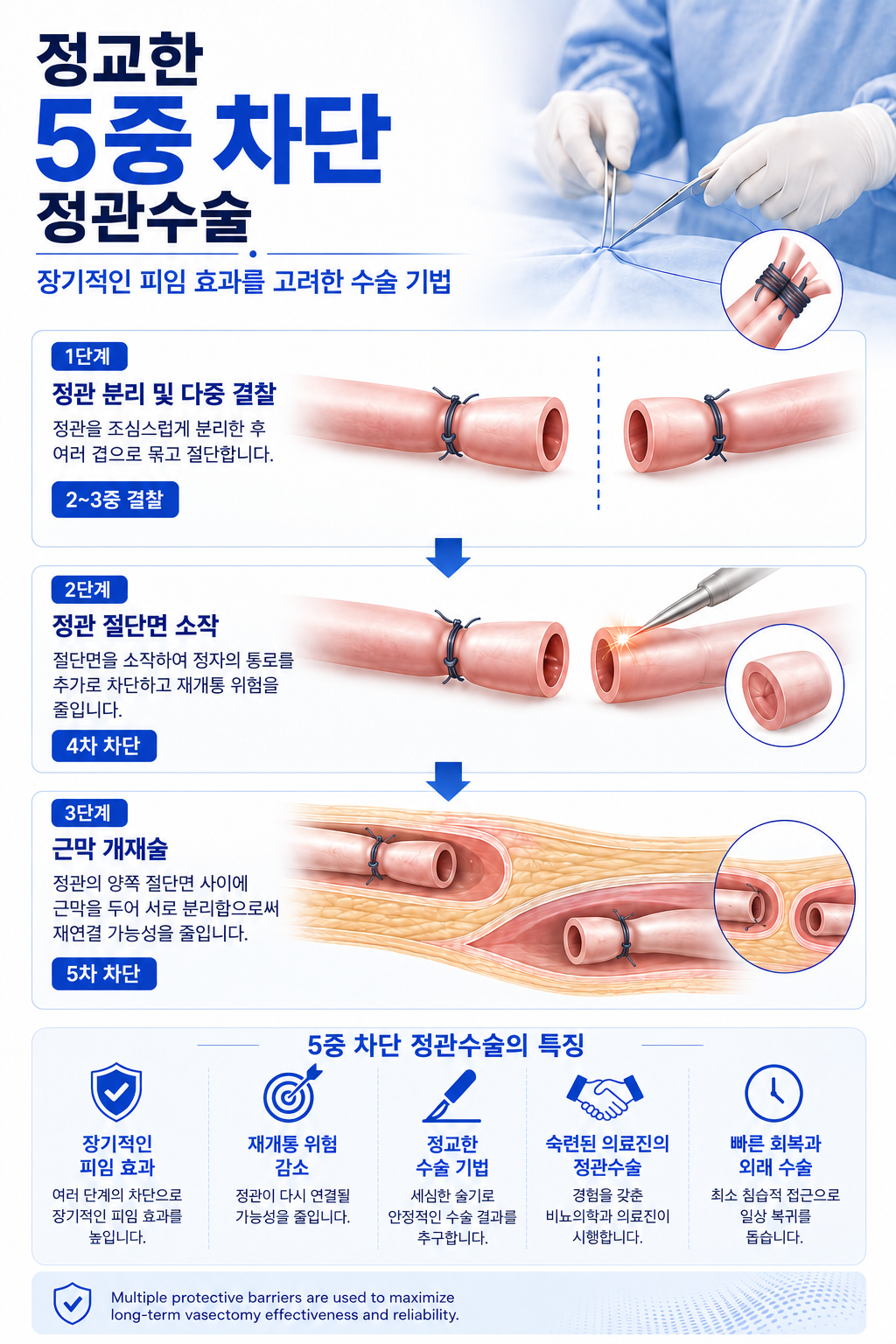 5중 차단 정관수술 기법 — 부산 서면 유로진남성의원