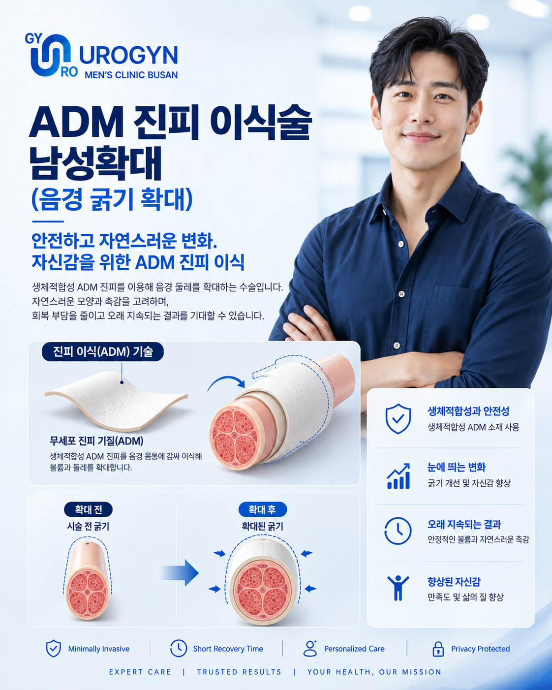 음경확대 — 부산 서면 유로진남성의원