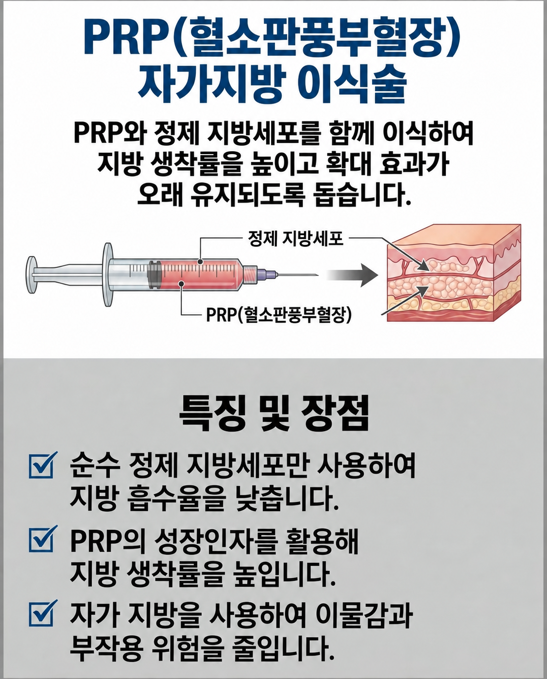 음경 자가지방이식 시술 모식도 — 부산 서면 유로진남성의원