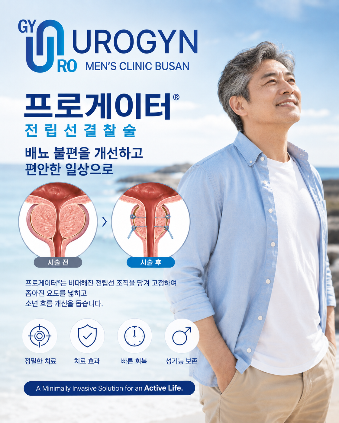 부산 서면 프로게이터 전립선 결찰술 — 유로진남성의원