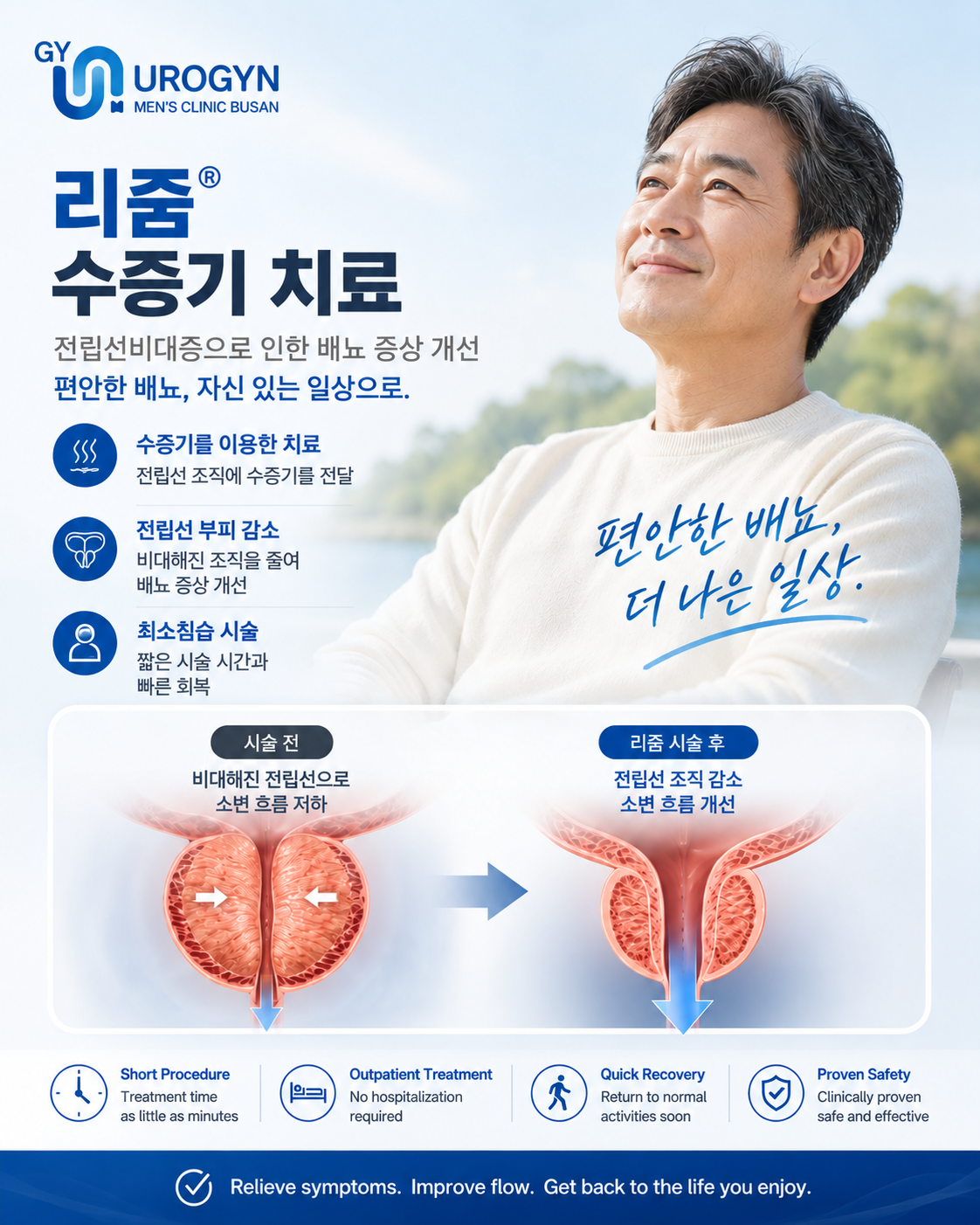 부산 서면 리줌 수증기 전립선비대증 치료 — 유로진남성의원