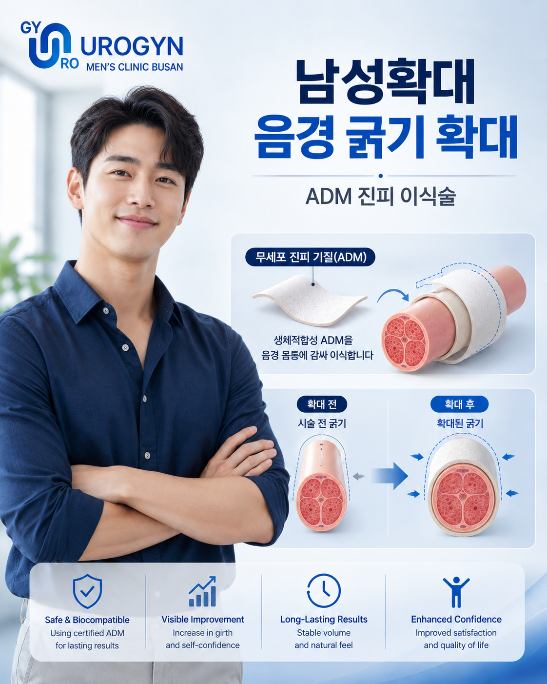 부산 서면 비뇨기과 음경확대 — 유로진남성의원