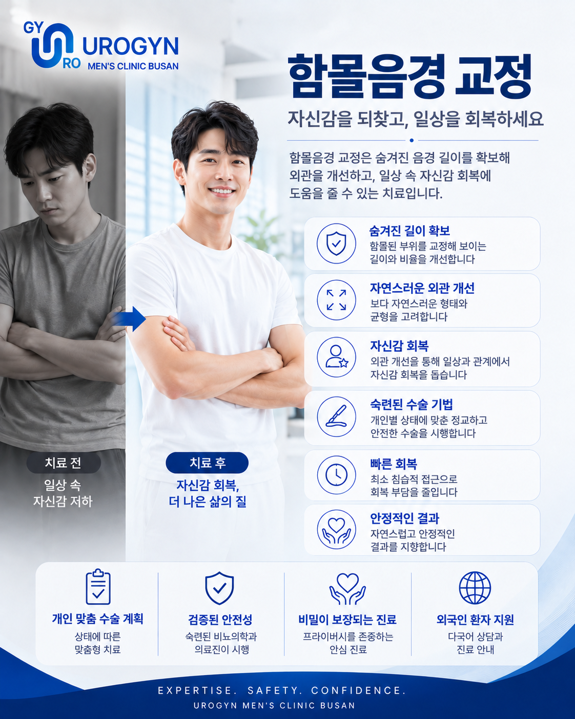 부산 서면 함몰음경(자라고추) 교정 · 치골 지방흡입 — 유로진남성의원
