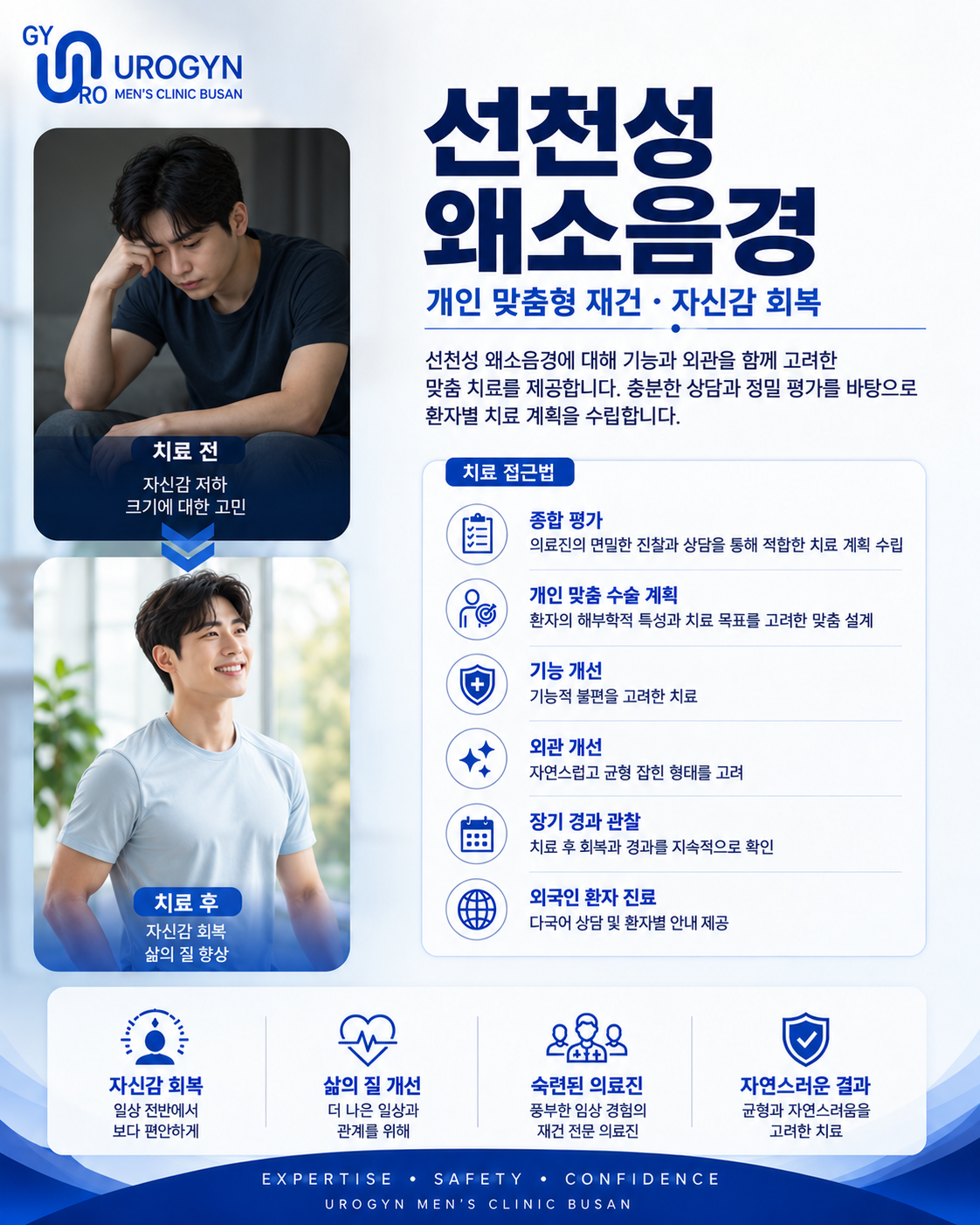 부산 서면 선천성 왜소음경 진료 — 유로진남성의원
