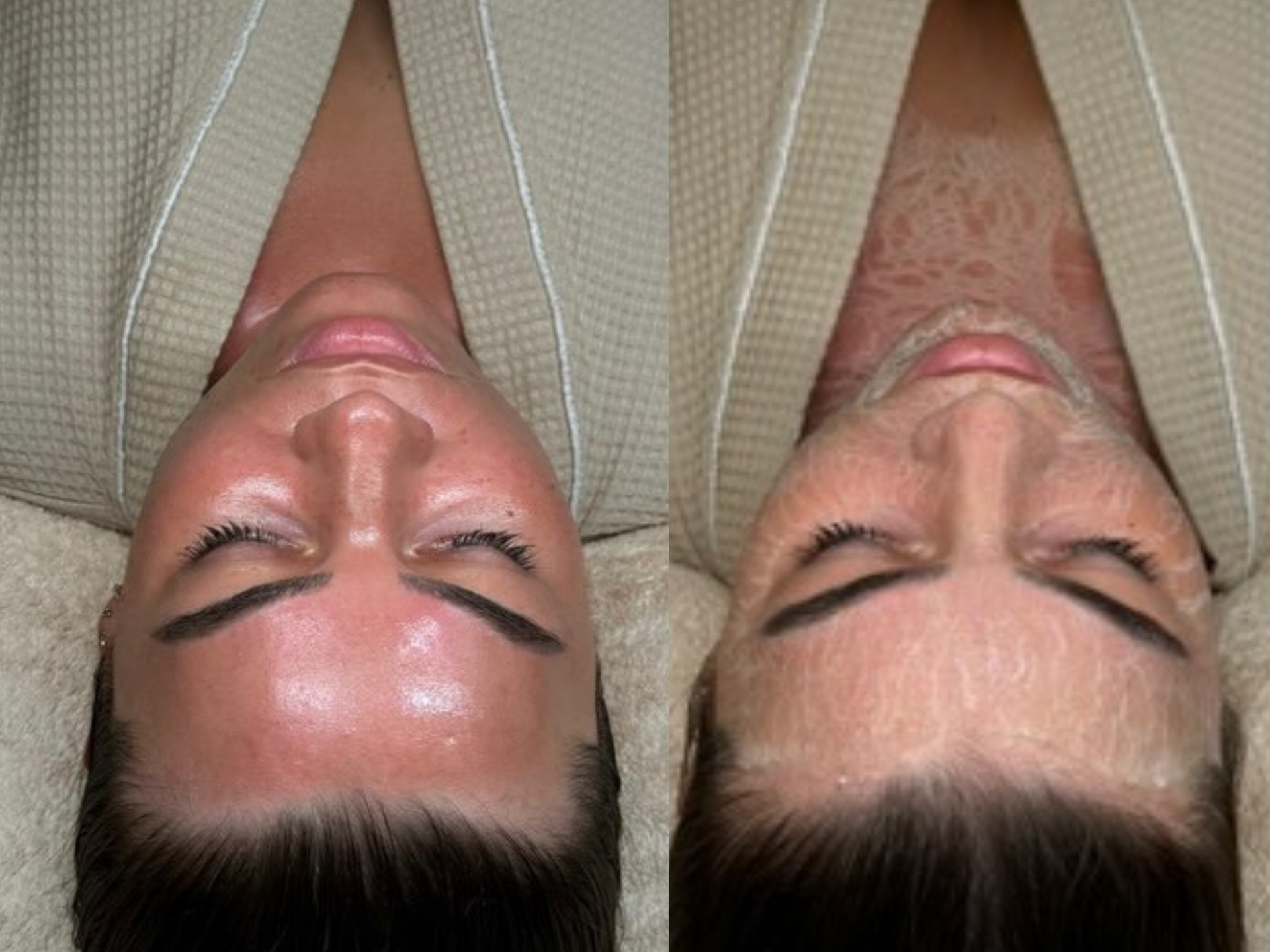 Before-and-after photos of a client having the Million Dollar Miracle Mask treatment. The after photo shows the client wearing the mask, with a dewy glow to the skin.