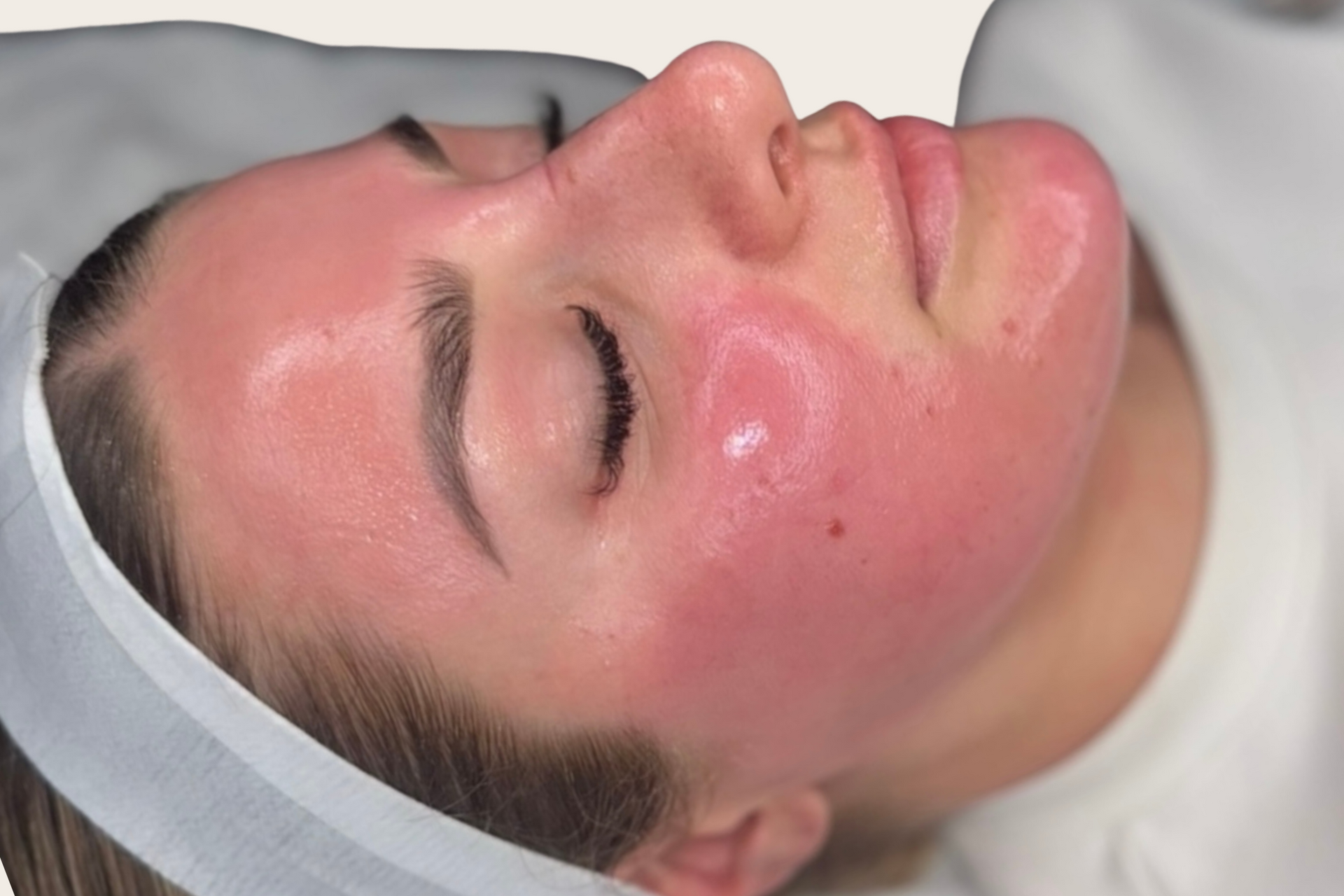A client’s skin looks slightly flushed and dewy after a Million Dollar Facial.
