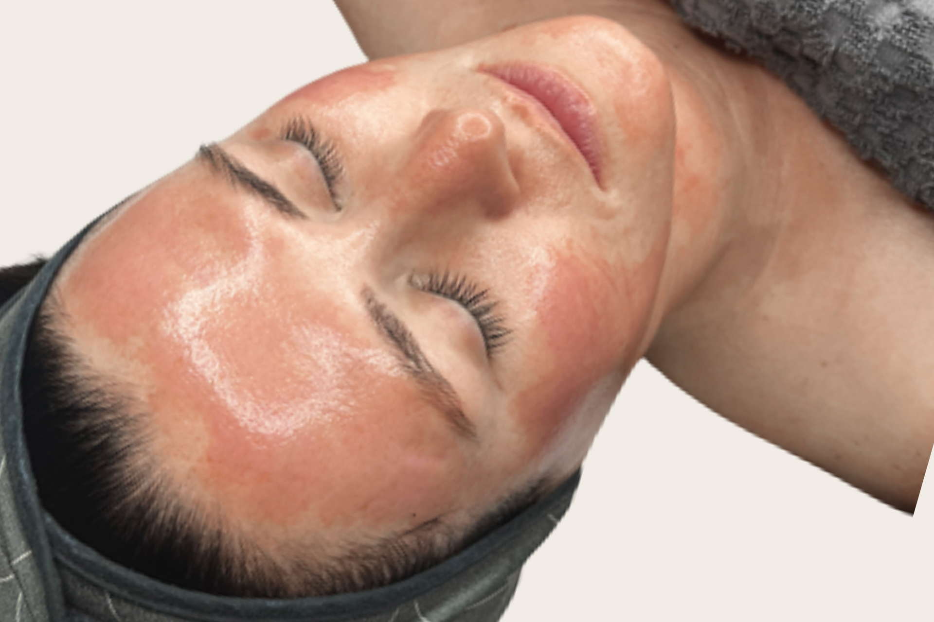 Close-up of a client’s glowing skin after a Million Dollar Facial.