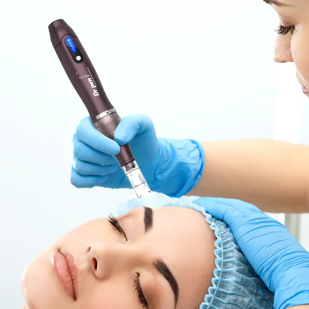 A therapist performing microneedling on a client’s face.