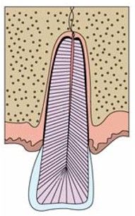 A drawing of a tooth with a hole in it.