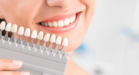 impianti in titanio e implantologia dentale a Bologna