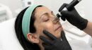 Person receiving facial laser treatment while wearing protective goggles and a white headband