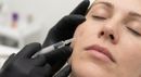 Gloved hand injecting a facial treatment into an older woman lying down under a hair net