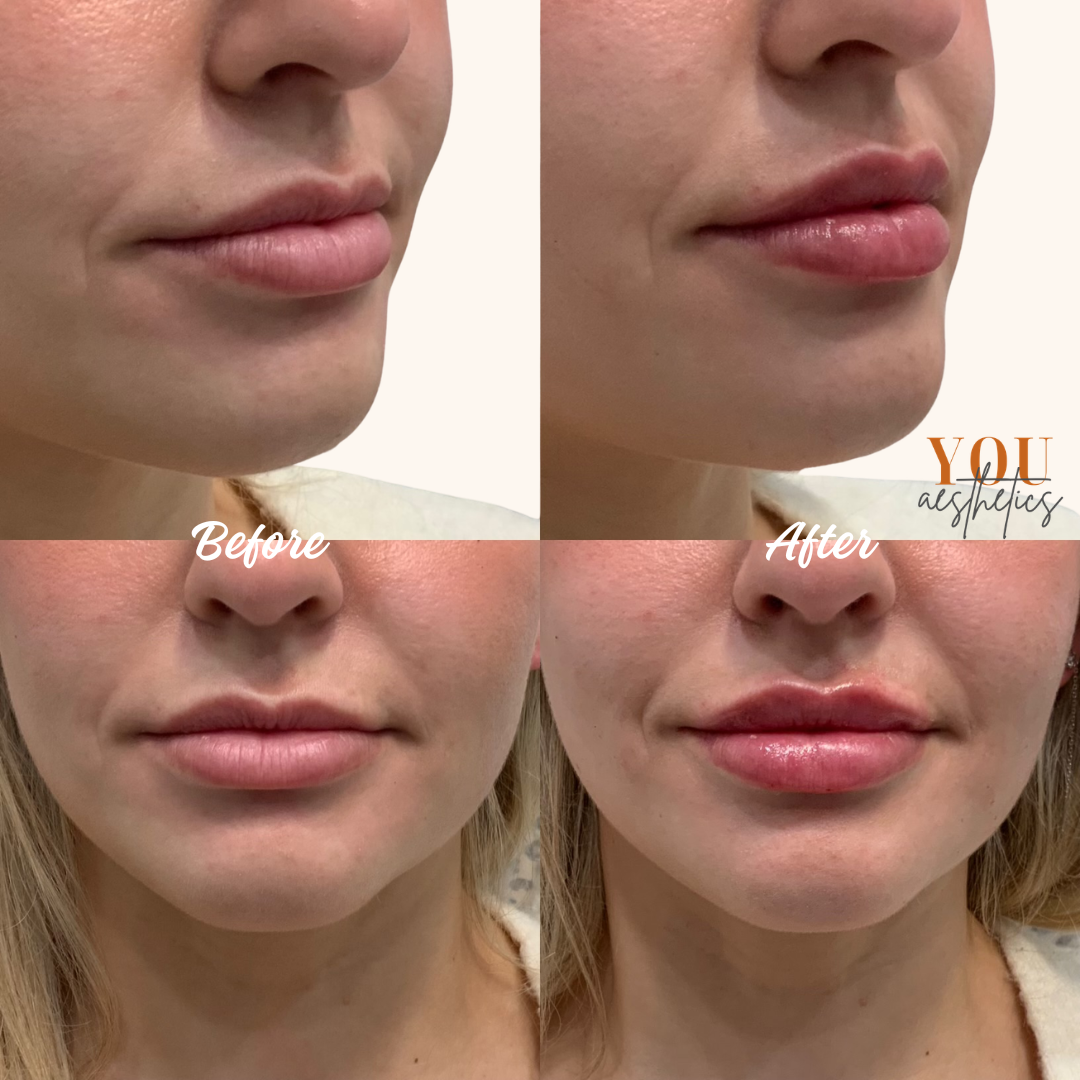 Side-by-side profile photos of a woman labeled “Before” and “After,” showing makeup/skin changes.