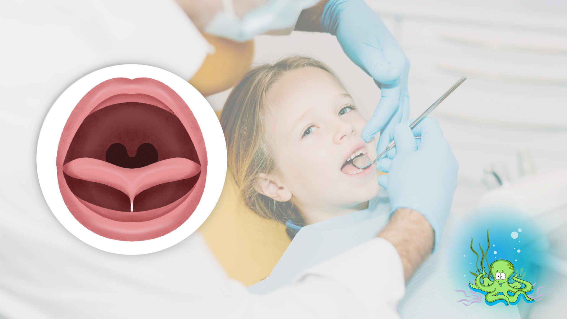 Girl at dentist with mouth open. Illustration of open throat. Cartoon octopus.