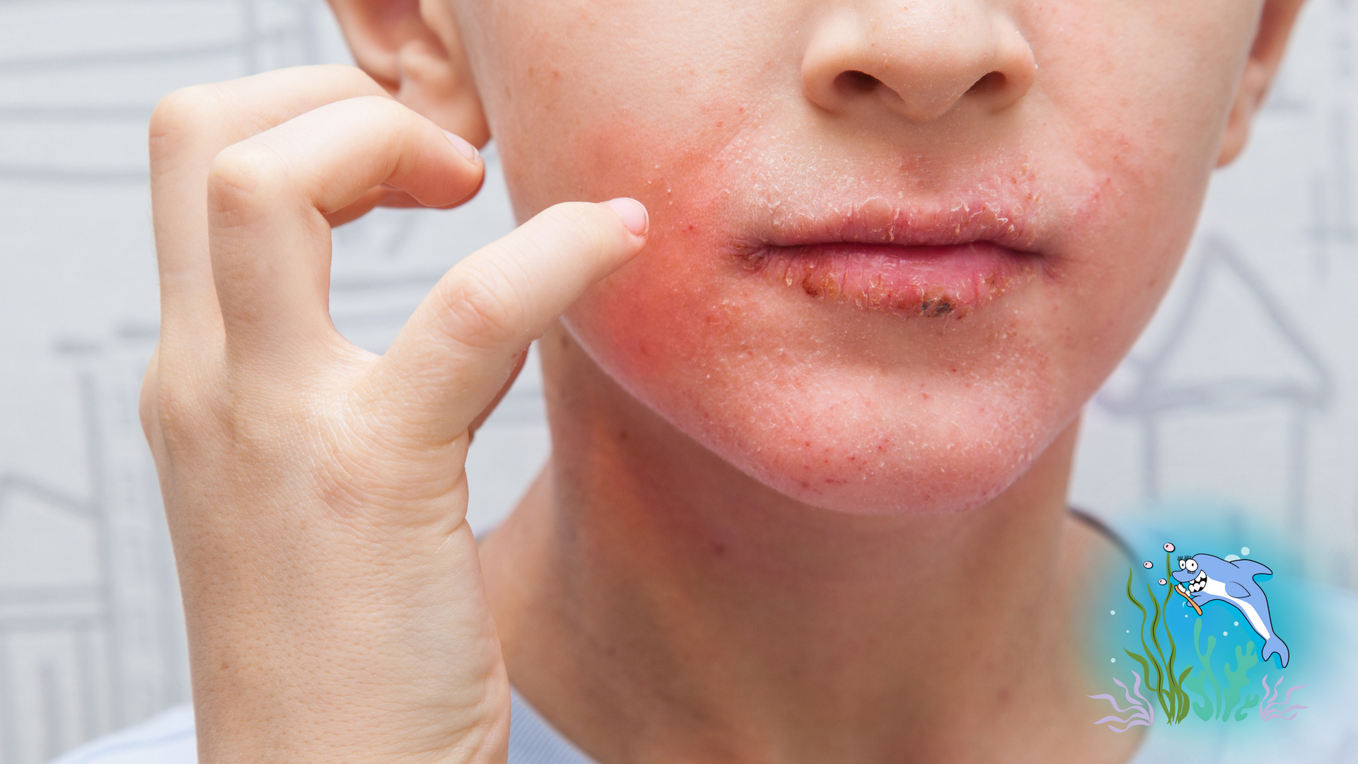 Person with red rash on face, touching cheek.
