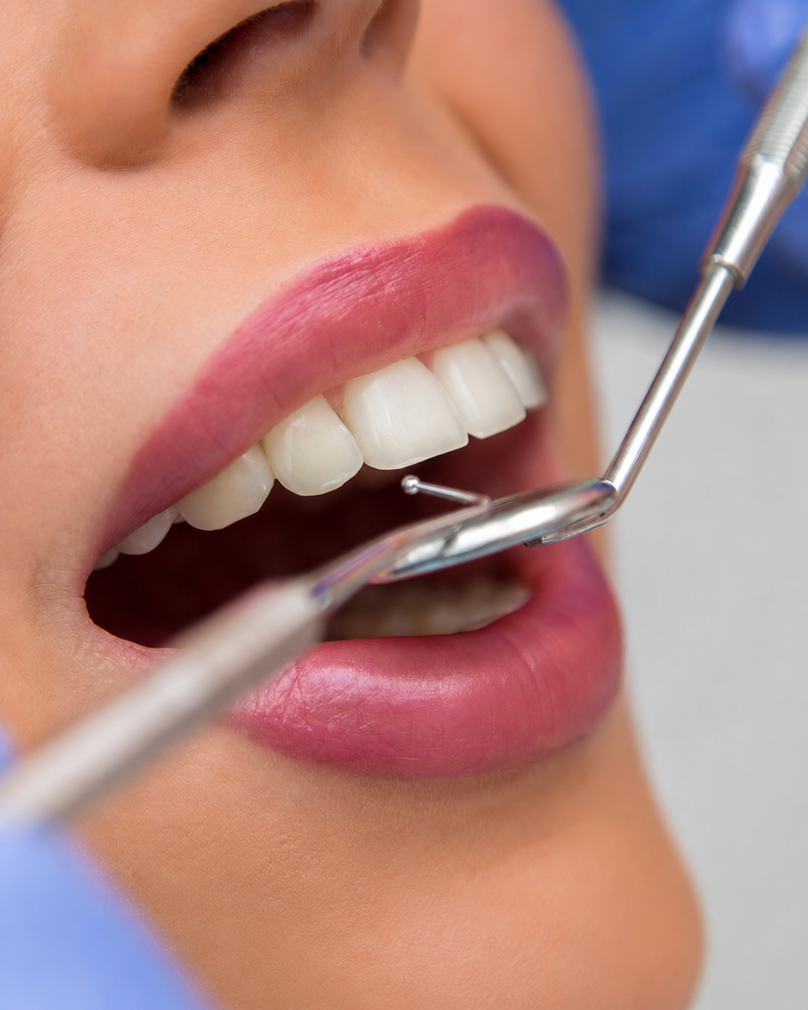 Igiene orale professionale presso Studio Dentistico Ninfa Floresta a Catania