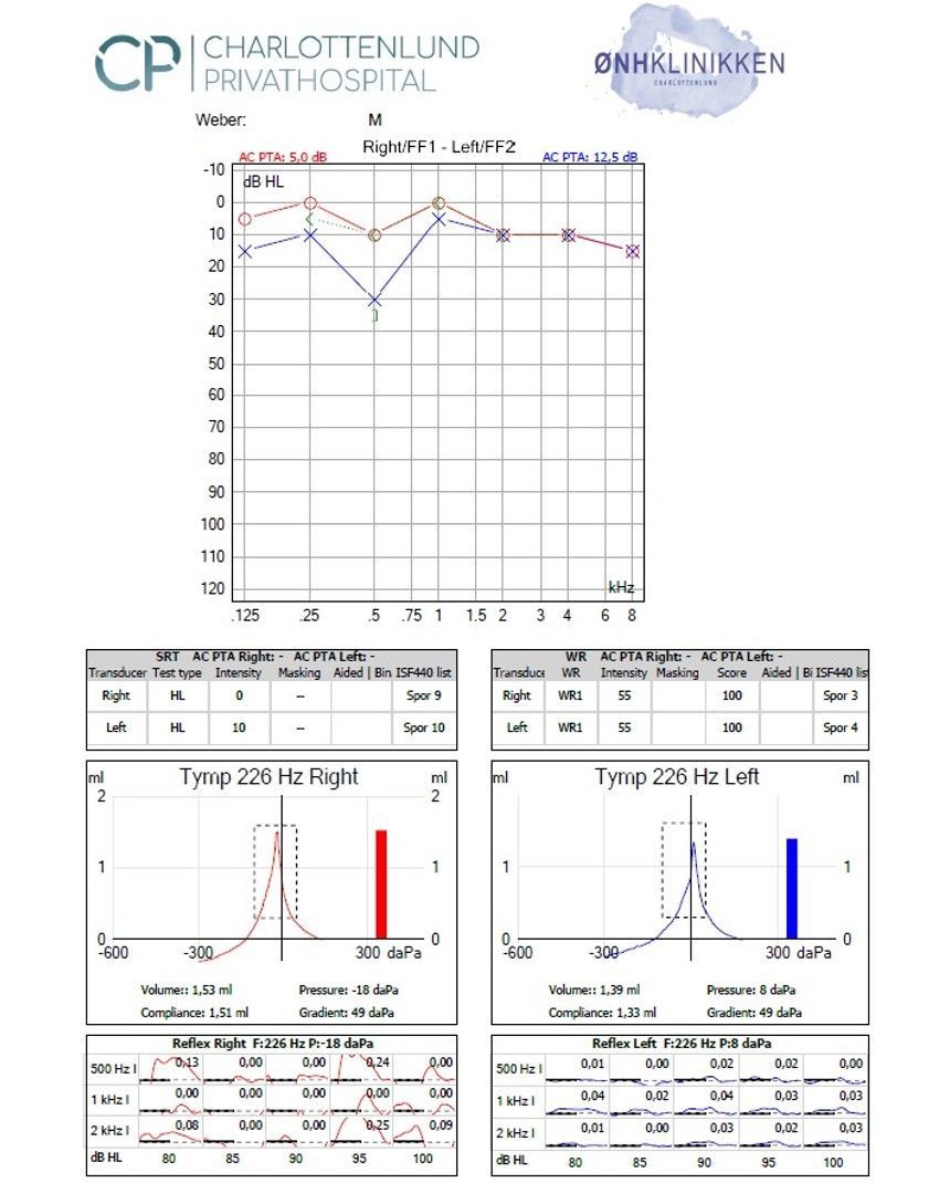 Audiogram, der viser resultater af høretest med grafer og diagrammer fra et hospital.
