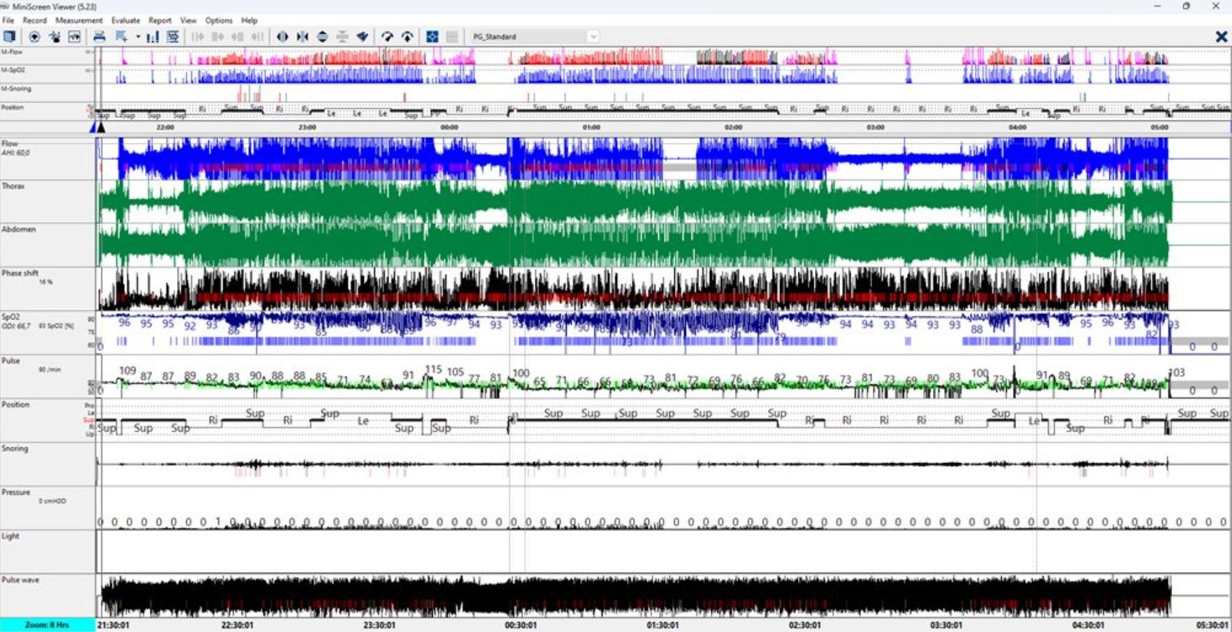 Skærmbillede af en softwaregrænseflade, der viser bølgeformer i forskellige farver, sandsynligvis til lyd- eller dataanalyse.