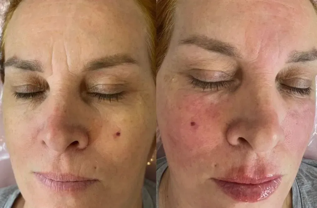 Tratamiento facial integral en Viviana Nails