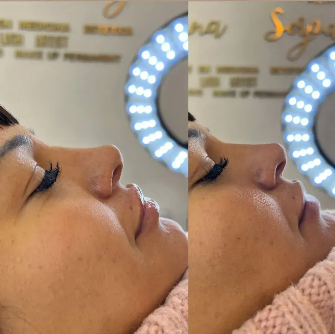 Rinomodelación en Viviana Nails