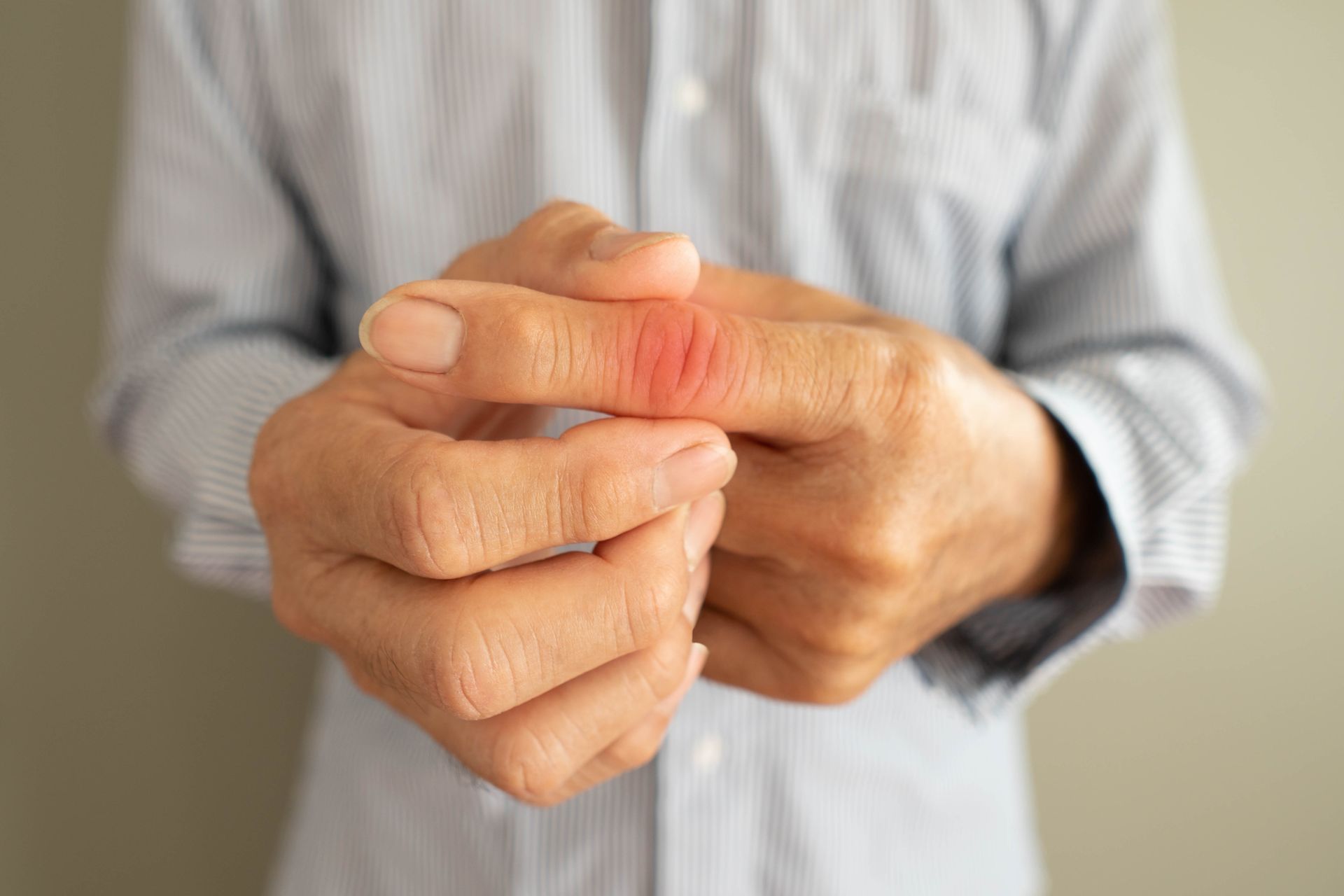 Person hält Hand, roter, entzündeter Finger.