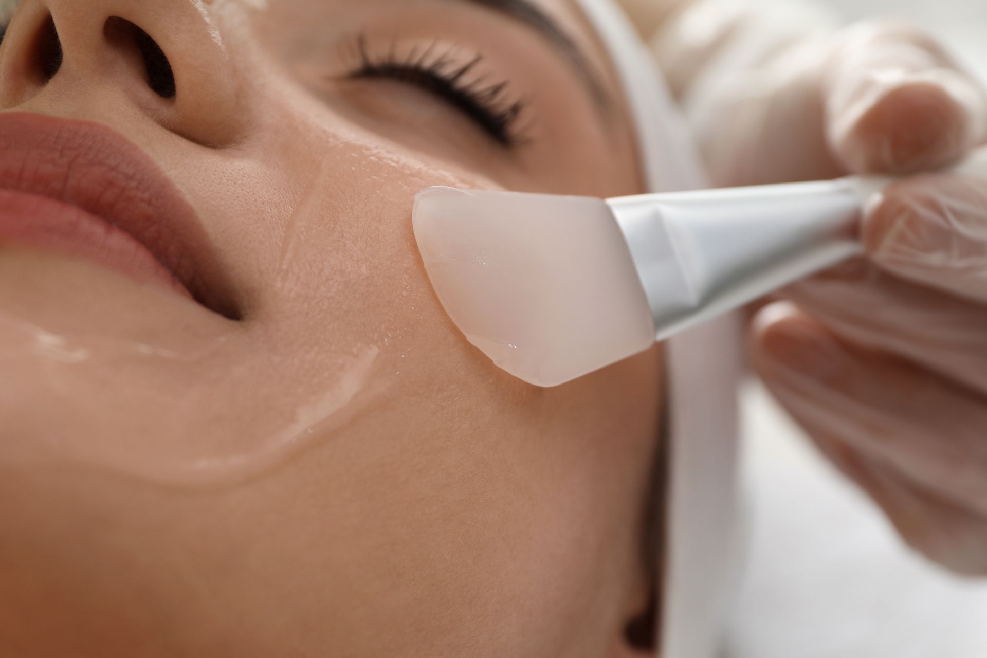 Person receiving facial peel treatment