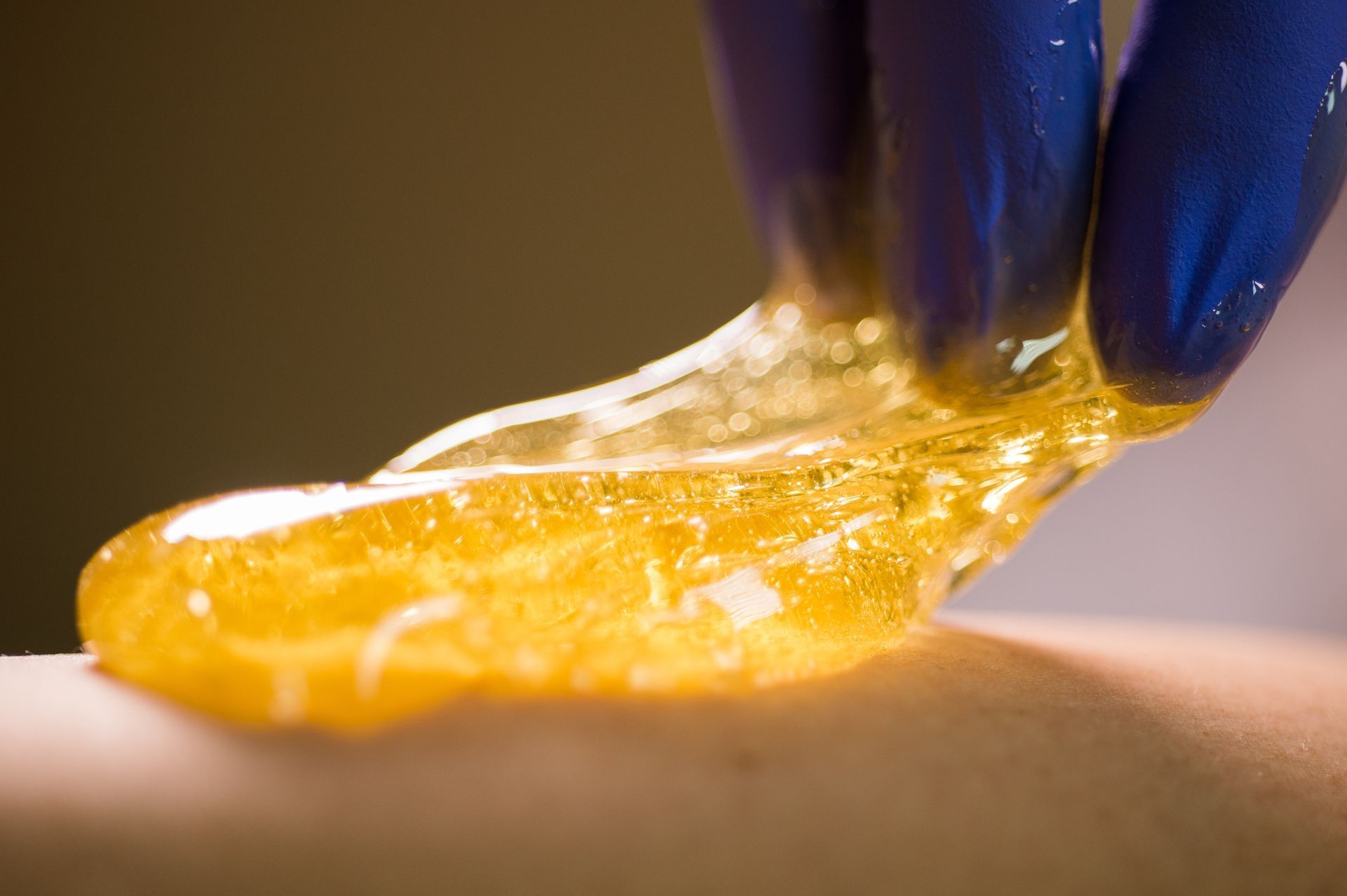 Gloved hand applying golden sugar wax to skin, for hair removal