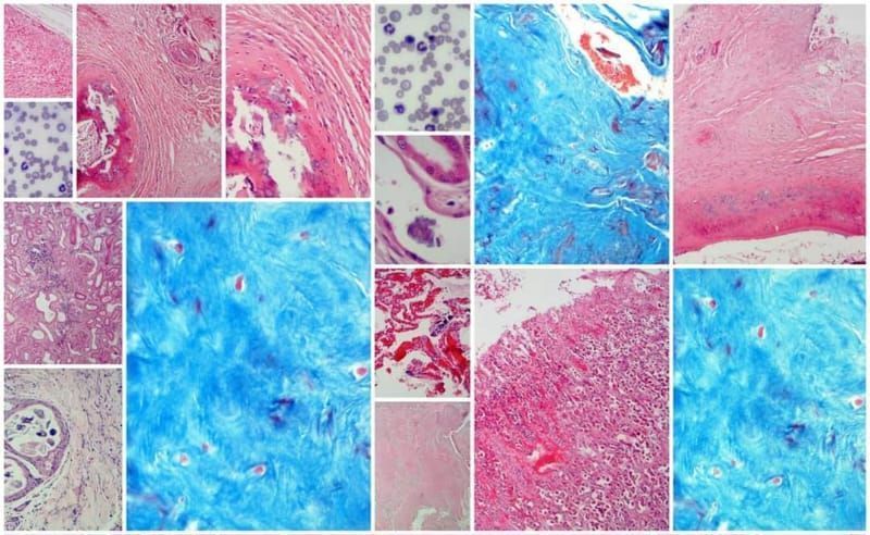 Vista microscópica de varias muestras de tejido teñidas con diferentes colores.